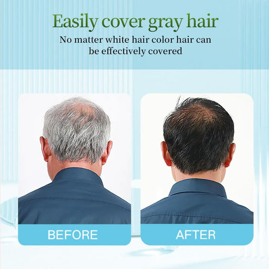 Apple Black Hair Color Shampoo 200ml | 3-in-1 Instant Coloring, Fast Action, Glossy Long-Lasting Finish